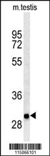 Anti-NMRK2 Rabbit Polyclonal Antibody