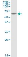 Anti-IL31RA Rabbit Polyclonal Antibody