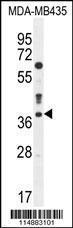 Anti-CASP3 Rabbit Polyclonal Antibody