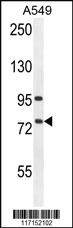 Anti-ALOX12B Rabbit Polyclonal Antibody