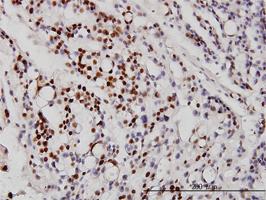 Anti-NEUROD1 Mouse Monoclonal Antibody [clone: 3H8]