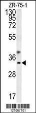 Anti-GCH1 Rabbit Polyclonal Antibody (PE (Phycoerythrin))