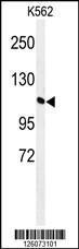 Anti-GTD2A Rabbit Polyclonal Antibody (APC (Allophycocyanin))