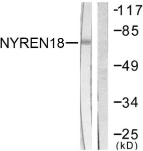 Western blot analysis of lysates from COS7 cells using Anti-NYREN18 Antibody. The right hand lane represents a negative control, where the antibody is blocked by the immunising peptide.