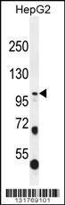 Anti-COL21A1 Rabbit Polyclonal Antibody (PE (Phycoerythrin))