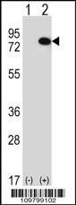 Anti-RIOK1 Rabbit Polyclonal Antibody (PE (Phycoerythrin))