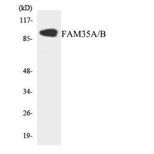 Western blot analysis of the lysates from 293 cells using Anti-FAM35A + FAM35B Antibody