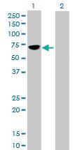 Anti-MMP8 Mouse Polyclonal Antibody