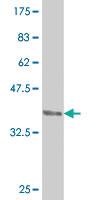 Anti-CDX4 Mouse Monoclonal Antibody [clone: 1E9]