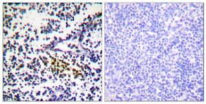 Immunohistochemical analysis of paraffin-embedded human tonsil tissue using Anti-NYREN18 Antibody. The right hand panel represents a negative control, where the antibody was pre-incubated with the immunising peptide.