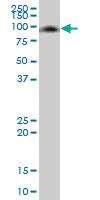 Anti-MMP8 Mouse Polyclonal Antibody