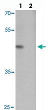 Anti-MLIP Rabbit Polyclonal Antibody