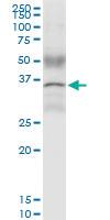 Anti-CCND1 Polyclonal Antibody Pair