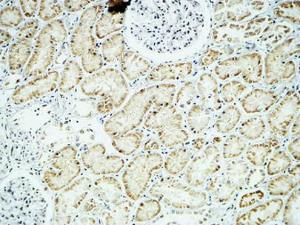 Anti-Alpha B Crystallin Rabbit Polyclonal Antibody