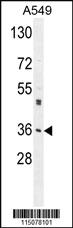 Anti-M6PR Rabbit Polyclonal Antibody