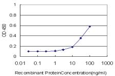 Anti-ZNF611 Mouse Monoclonal Antibody [clone: 4F1]