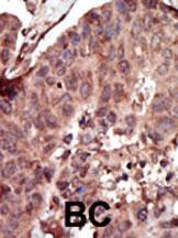 Anti-PKLR Rabbit Polyclonal Antibody (Biotin)