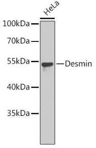 Anti-Desmin antibody