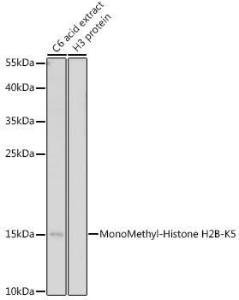 Western blot analysis of extracts of C6 cells, using Anti-Histone H2B (mono methyl Lys5) Antibody (A93072) at 1:500 dilution. The secondary antibody was Goat Anti-Rabbit IgG H&L Antibody (HRP) at 1:10,000 dilution.