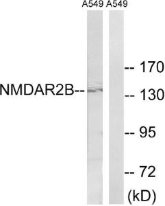 Anti-NMDAR2B Rabbit Polyclonal Antibody