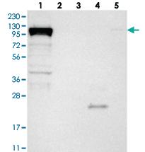 Anti-DHX36 Rabbit Polyclonal Antibody