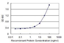 Anti-CD40L Antibody Pair