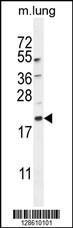 Anti-MAPG8a/b Rabbit Polyclonal Antibody (FITC (Fluorescein Isothiocyanate))