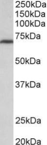 Anti-MTHFR Antibody (A85000) (0.3 µg/ml) staining of NIH3T3 lysate (35 µg protein in RIPA buffer). Primary incubation was 1 hour. Detected by chemiluminescence