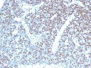 Immunohistochemical analysis of formalin-fixed, paraffin-embedded human lymph node using Anti-LEF1 Antibody [LEF1/341R] (2 µg/ml). Note, strong nuclear staining of non-germinal center cells