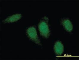 Anti-TTN Mouse Monoclonal Antibody [clone: 8G9]