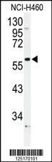 Anti-ADRA1B Rabbit Polyclonal Antibody