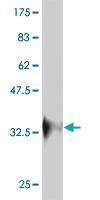 Anti-RNF213 Mouse Monoclonal Antibody [clone: 5C12]