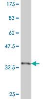 Anti-CDX4 Mouse Monoclonal Antibody [clone: 3F11]