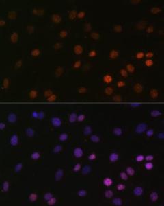 Immunofluorescence analysis of C6 cells using Anti-Histone H2B (mono methyl Lys5) Antibody (A93072) at a dilution of 1:100. DAPI was used to stain the cell nuclei (blue).