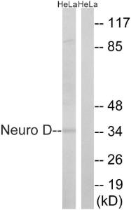 Western blot analysis of lysates from HeLa cells using Anti-Neuro D Antibody. The right hand lane represents a negative control, where the antibody is blocked by the immunising peptide