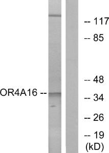 Western blot analysis of lysates from COLO cells using Anti-OR4A16 Antibody. The right hand lane represents a negative control, where the antibody is blocked by the immunising peptide