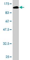 Anti-VCAM1 Mouse Monoclonal Antibody [clone: 1H6]