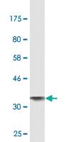 Anti-ALPL Mouse Monoclonal Antibody [clone: 3A7]