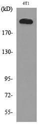 Western blot analysis of lysate from 4T1 cells using Anti-MYH-pan Antibody