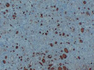 Anti-Thyroglobulin Mouse Monoclonal Antibody [clone: ABT-TG]