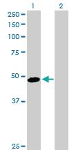 Anti-AHSG Rabbit Polyclonal Antibody