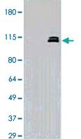 Anti-NEDD9 Mouse Monoclonal Antibody [clone: 14A11]