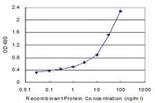 Anti-CD40L Antibody Pair