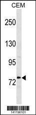 Anti-MTHFR Rabbit Polyclonal Antibody (AP (Alkaline Phosphatase))