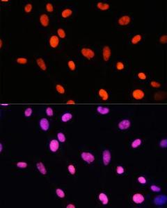 Immunofluorescence analysis of NIH-3T3 cells using Anti-Histone H2B (mono methyl Lys5) Antibody (A93072) at a dilution of 1:100. DAPI was used to stain the cell nuclei (blue).