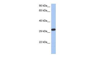 Anti-CAPZA3 Rabbit Polyclonal Antibody