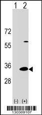 Anti-DAPP1 Rabbit Polyclonal Antibody (HRP (Horseradish Peroxidase))