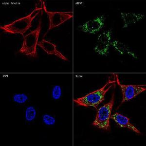 Anti-ATP5A Rabbit Monoclonal Antibody [clone: ARC0549]