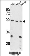 Anti-FOXP3 Rabbit Polyclonal Antibody