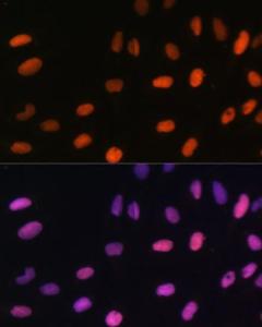 Immunofluorescence analysis of U-2 OS cells using Anti-Histone H2B (mono methyl Lys5) Antibody (A93072) at a dilution of 1:100. DAPI was used to stain the cell nuclei (blue).